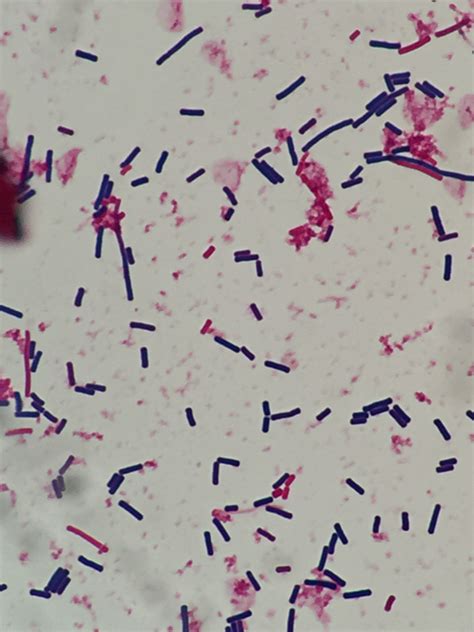 Clostridium perfringens〔パーフリンジェンス〕 | グラム染色: Gram Stain