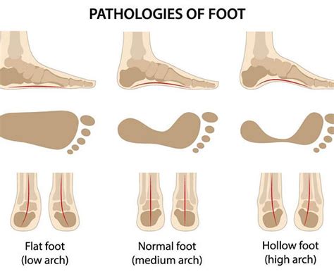 The Difference Between Supination And Pronation Carl Todd Clinic | eduaspirant.com