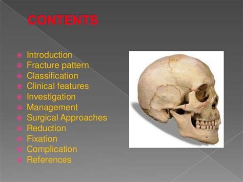 ZYGOMATICO MAXILLARY COMPLEX FRACTURE