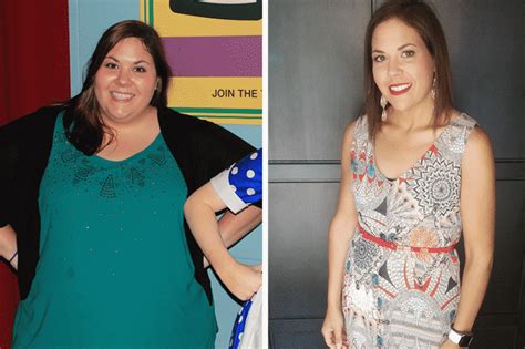 Sarah P. (Age:32) – Advanced Bariatrics of Northern Illinois