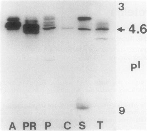 Peroxidase isozymes from apple (A), pear (PR), peach (P), | Download Scientific Diagram