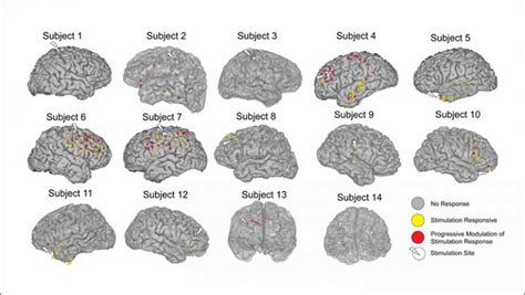 How electrical stimulation reorganizes the brain - Neuroscience News