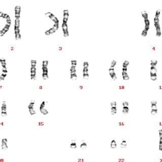 (PDF) Cytogenetic Techniques in Diagnosing Genetic Disorders