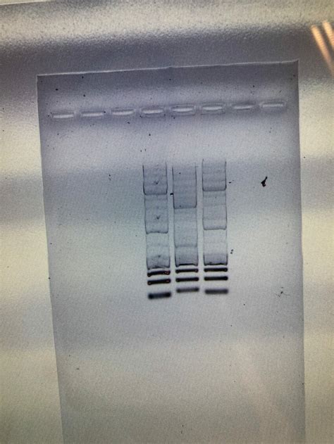 346 questions with answers in COLONY PCR | Scientific method