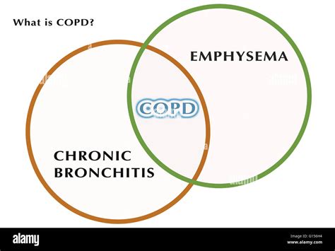 Diagram showing the relationship between chronic bronchitis, COPD ...