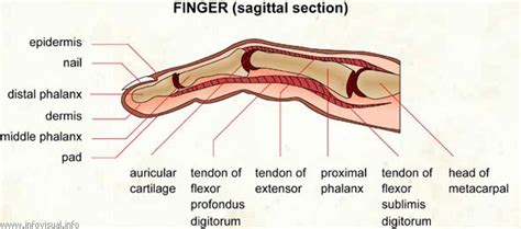 Understanding Williams Syndrome: Curved fingers and toes- Clinodactyly