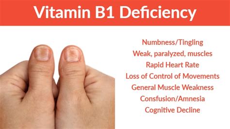 Vitamin B1 Benefits, Deficiency and Foods - Dr. Daniel Functional Medicine