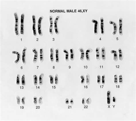 Normal male 46,XY human karyotype | Wellcome Collection