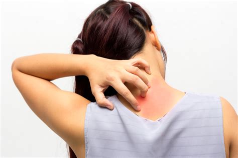 Skin Reaction to Scratching - What is it? - Colorado Allergy & Asthma ...