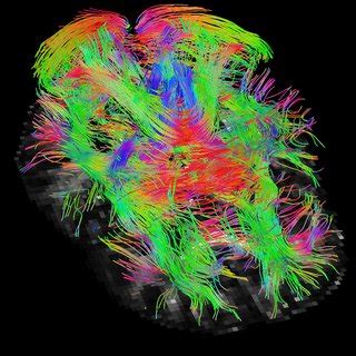 Tractography visualization results on the in vivo brain data. (a)... | Download Scientific Diagram