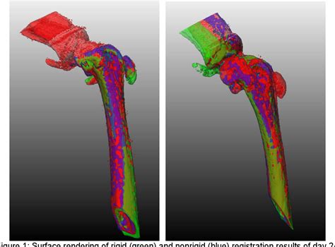 Figure 1 from Nonrigid registration for the longitudinal analysis of micro-CT bone datasets ...