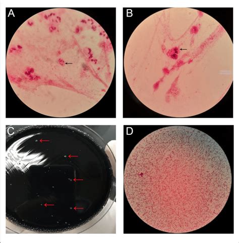 | (A,B) Gram stain of bronchoalveolar lavage fluid (BALF) with arrows... | Download Scientific ...