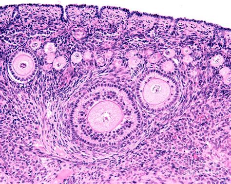 Ovarian Follicles #3 Photograph by Jose Calvo/science Photo Library - Pixels