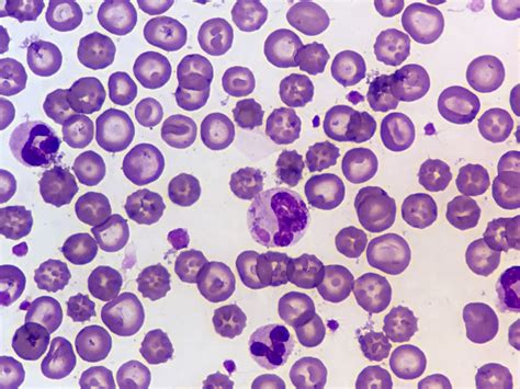 Inclusion Bodies: Preventing their Formation - Molecular Depot