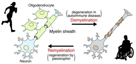 New Study Unravels How Myelin is Repaired, May Suggest New MS Treatments