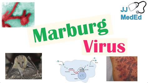 Marburg Virus Symptoms - Marburg virus, TEM - Stock Image - C002/3020 ...