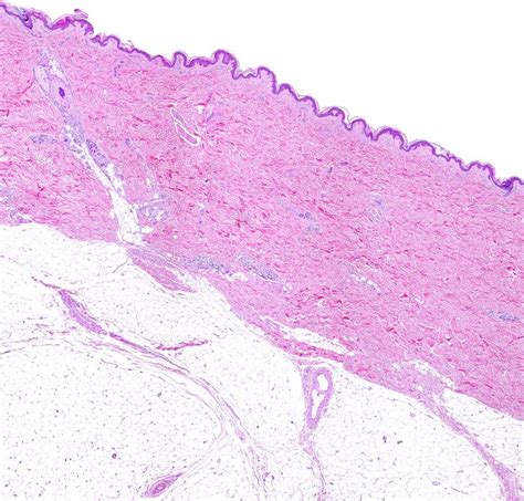 Hypodermis Histology