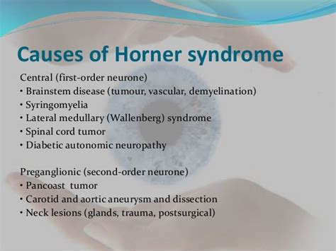 Horners syndrome