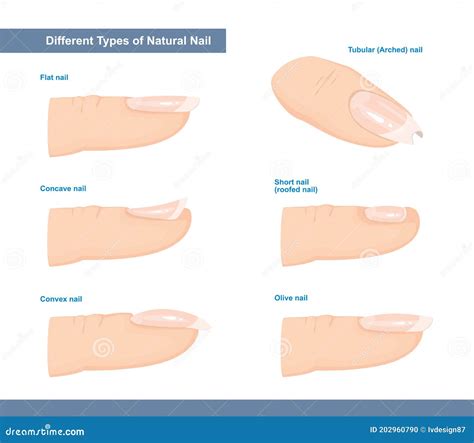 Different Types of Fingernail. Normal, Short, Roofed, Tubular, Arched, Flat, Convex and Concave ...