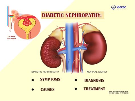 Diabetic Nephropathy: Symptoms, Diagnosis, Causes, and Treatment