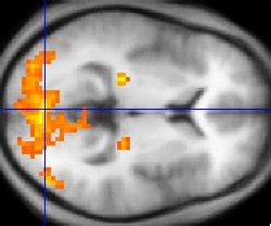 Brain Imaging Techniques | Boundless Psychology