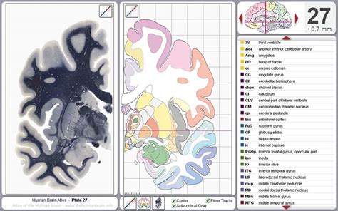 The Human Brain · Atlas of the Human Brain · Sections · Virtual Microscopy