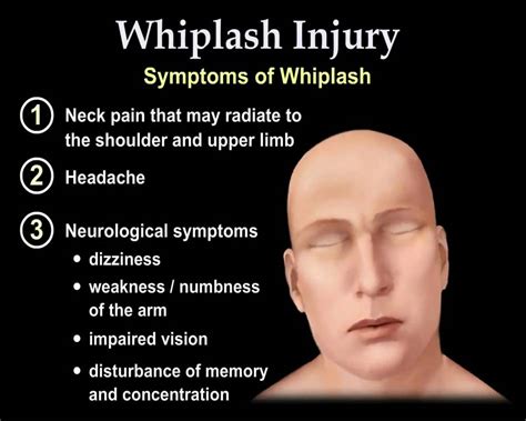 Whiplash Injury Animation - Everything You Need to Know - Dr. Nabil ...