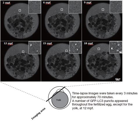 Autophagy Applications New Application | Autophagy Research | Olympus LS