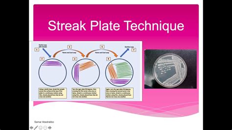 Streak Plate Technique Lab - YouTube