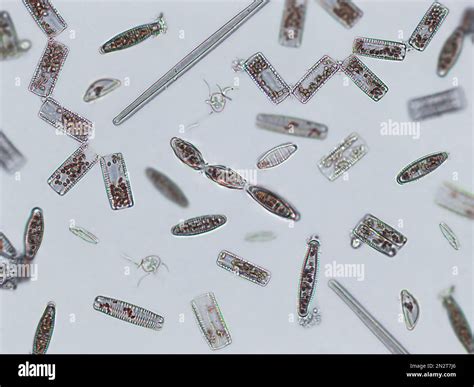 Diatoms, algae under microscopic view, phytoplankton, fossils, silica ...