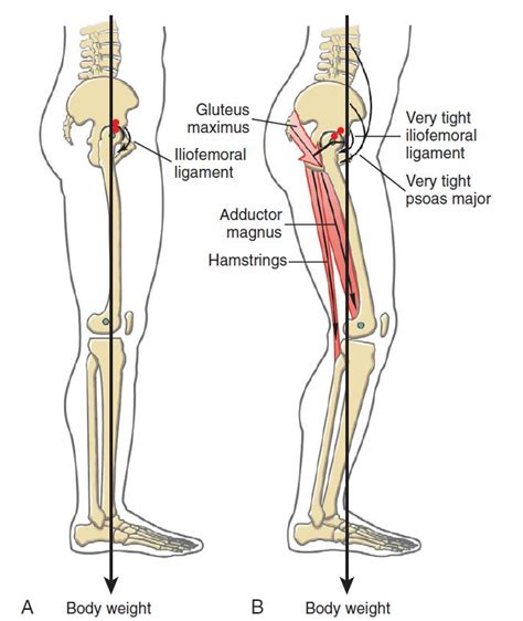 The Ultimate Guide to Improving Hip Extension