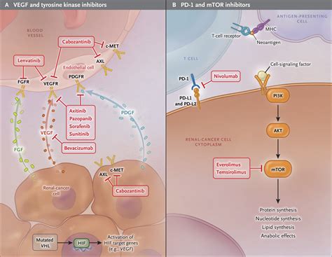 Systemic Therapy for Metastatic Renal-Cell Carcinoma | NEJM