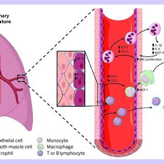 | Overview of major inflammatory pathways involved in the pathogenesis ...