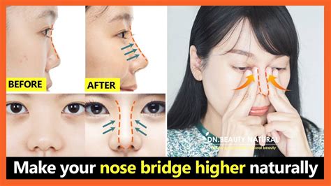 5 Best steps!! How to lift your nose bridge higher, get perfect nose without surgery. - YouTube