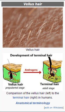 vellus hair and dermaplaning | Dermaplaning, Vellus hair, Hair removal diy