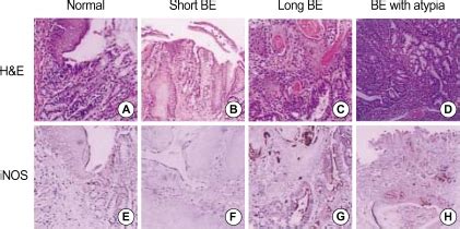 Histology and immunohistochemical staining of esophagogastric junction ...