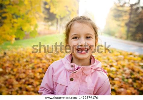 Portrait Cute Little Girl Missing Teeth Stock Photo 1499379176 | Shutterstock