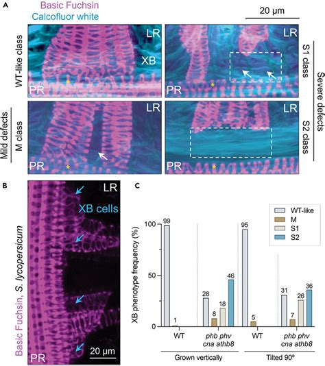 Characterization of xylem bridge defects during lateral root... | Download Scientific Diagram