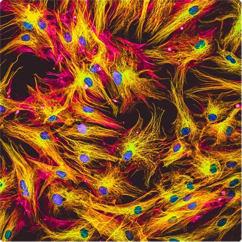 Quantum Dots as Molecular Probes for Fluorescence Microscopy