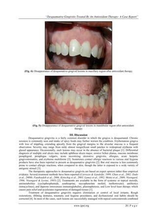 “Desquamative Gingivitis Treated By An Antioxidant Therapy- A Case Report” | PDF