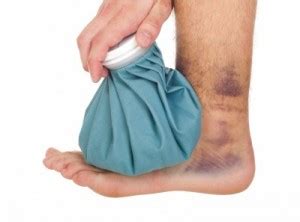 Treating Soft Tissue Injuries