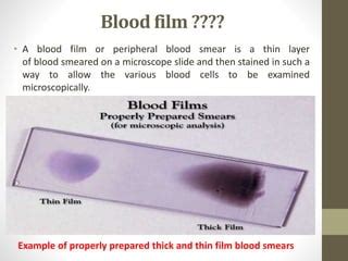 Blood smear staining | PPT