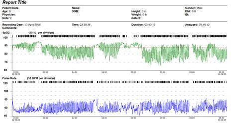 Overnight Oximetry Screening - HOMECARE MEDICAL