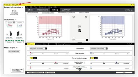 Interton Fitting Software - Hearing Aid Self-Fitting and Adjusting [DIY ...