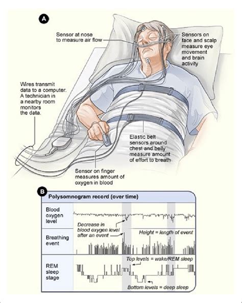 Illustration of the polysomnogram device. (a) Illustration of the... | Download Scientific Diagram