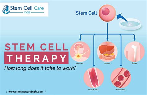 What are Stem Cells and How Long Does the Therapy Take? Home