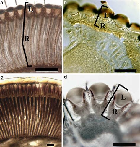 Comparison of the ommatidia of the compound eye region of male ...