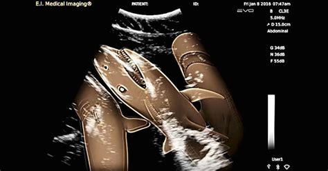 Amazing footage of pregnant shark's ultrasound scan - with 20 babies shown wriggling around ...