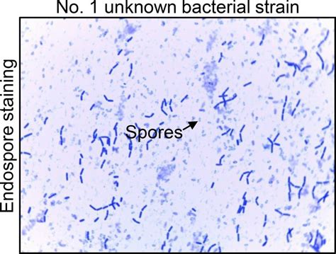 Bacillus Subtilis Microscope