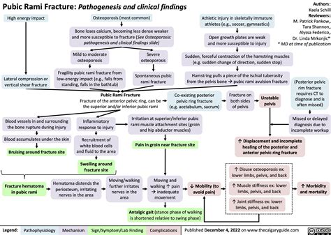 Pubic Rami Fracture: Pathogenesis and clinical findings | Calgary Guide